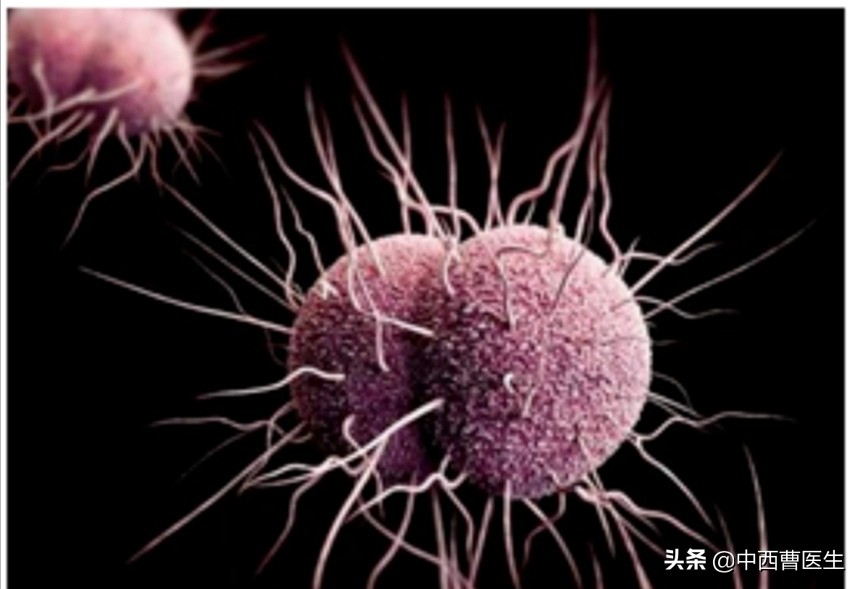 淋病除了性传播还有什么传播,淋病是性传播主要原因吗