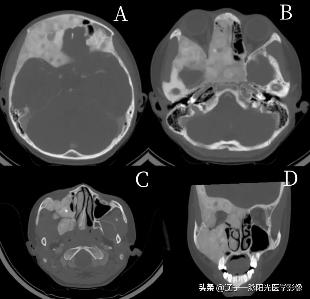 眼部疾病诊断有哪些,眼部病变有哪些症状
