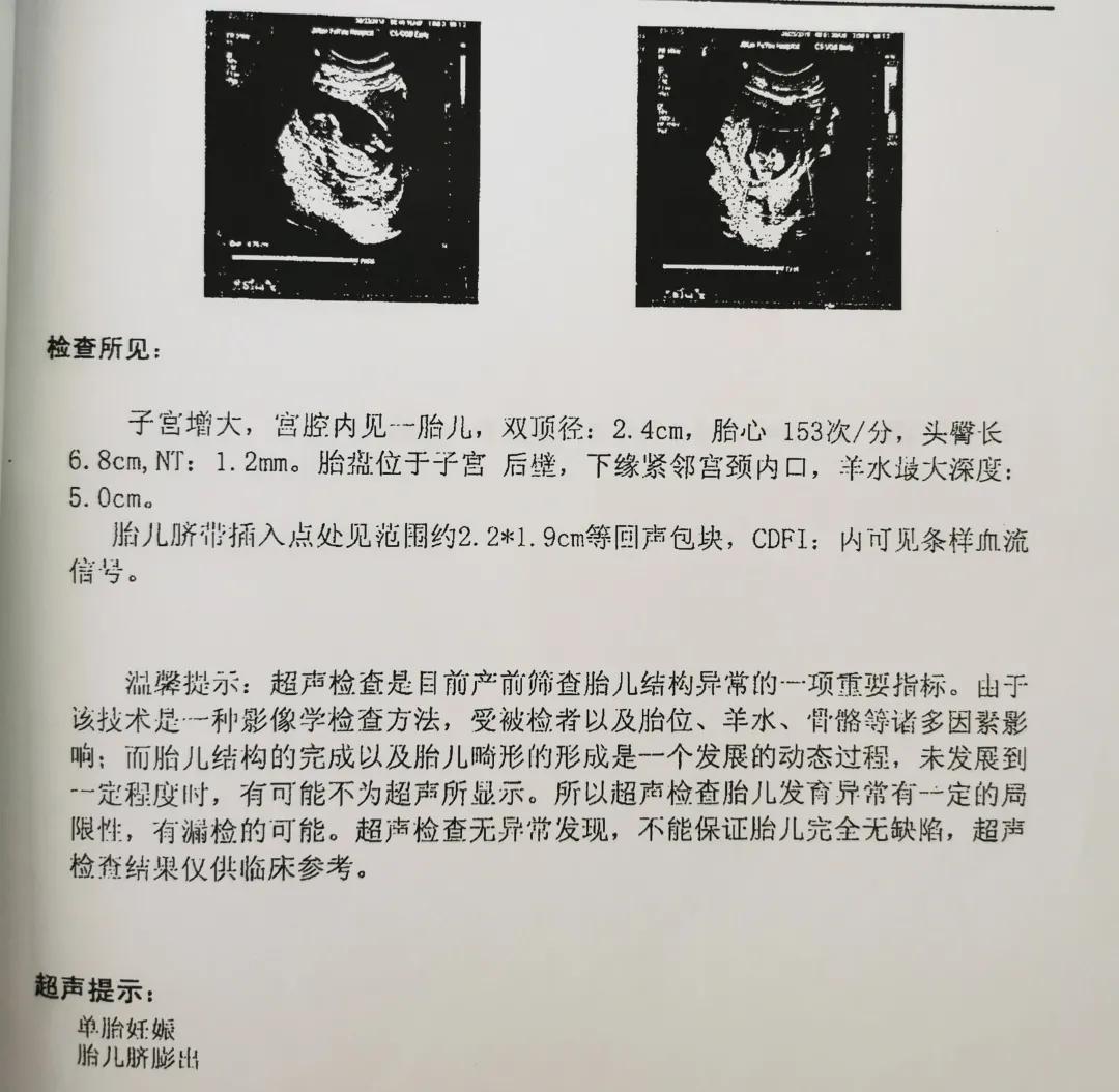 两次引产经历对身体有哪些影响,两年经历两次的引产痛苦