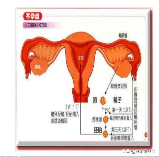 女人不孕找神医后续,女人不孕不育十大原因