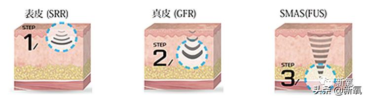 宋祖儿雀斑造型美到窒息,宋祖儿脸上的雀斑一清二楚