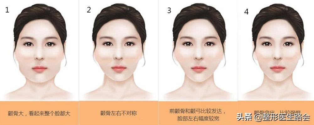 颧骨高又突出改善的最快方法,颧骨高改善按摩手法