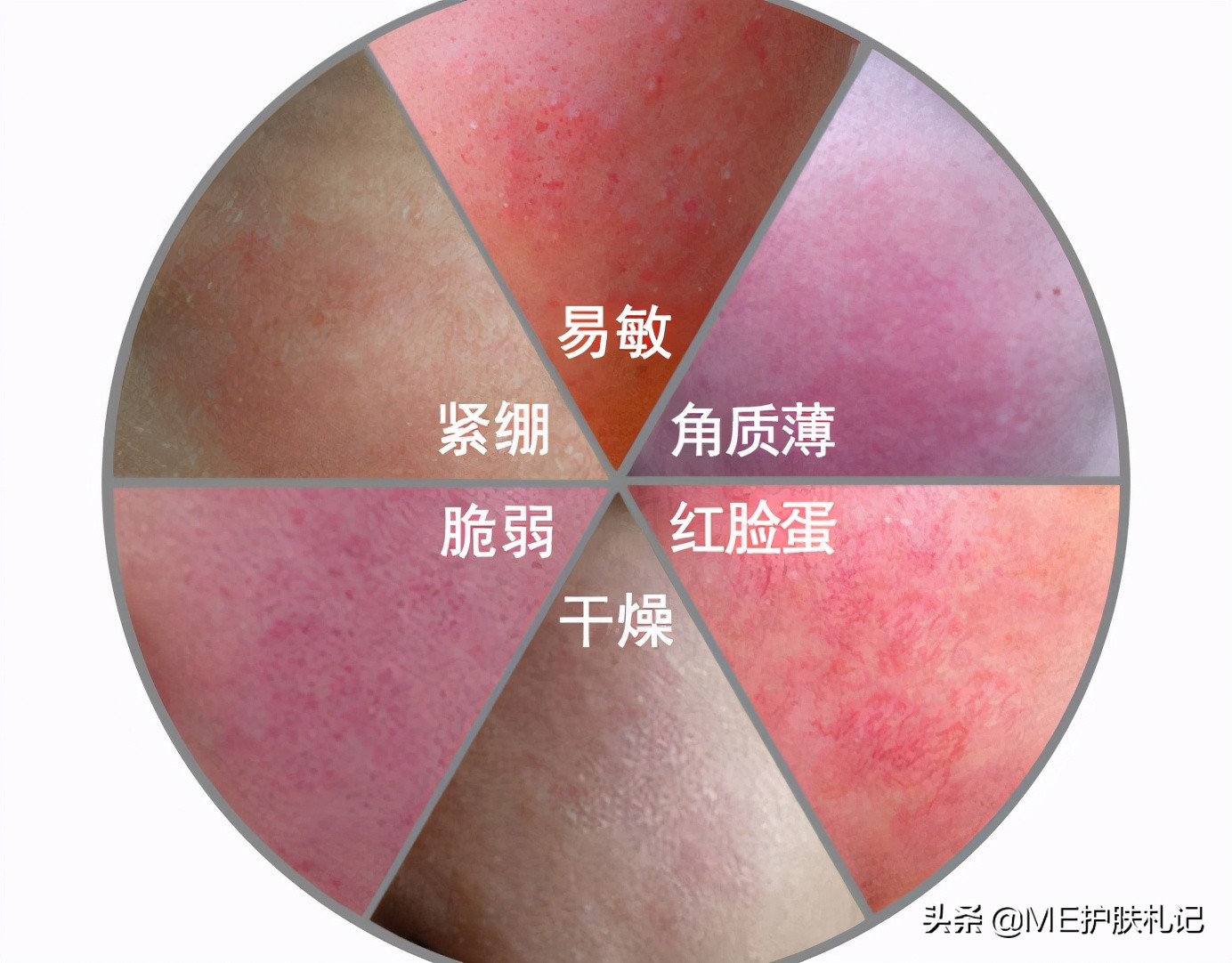 胶原蛋白护肤的正确用法,me胶原水光怎么样