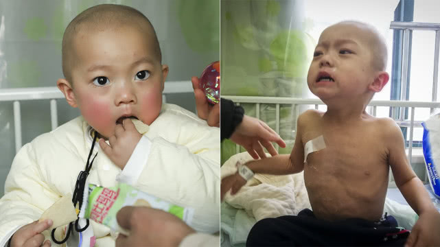 一岁萌娃拒绝妈妈喂饭要自己吃,萌宝患重症拒绝吃奶