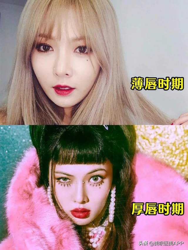 凸嘴女孩的发型侧面好看,水原希子是什么脸型