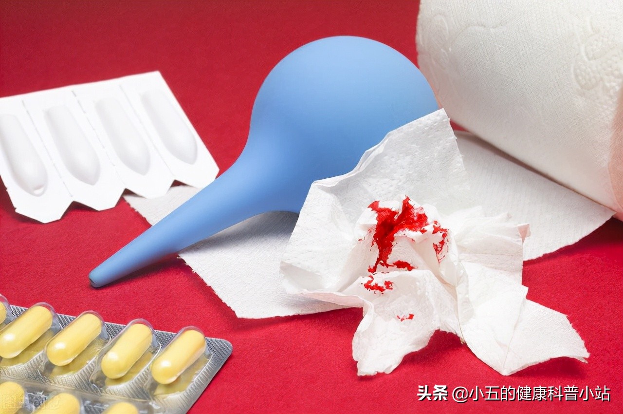 得了痔疮的人平时应该如何护理?除药物和手术治疗外还需注意6点