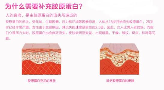 有眼纹了怎么办,30岁有眼袋眼纹很显老的感觉