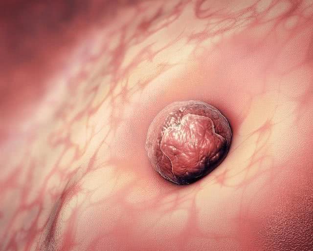 怀孕不到10天会有什么反应,怀孕未见明显血流信号是好还是坏