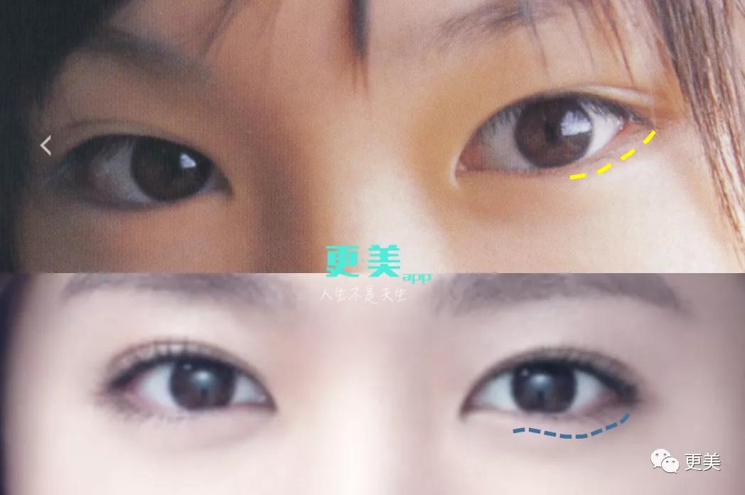 超越钟楚曦的“do脸王者”！翻了1000张照片终于知道她多牛…