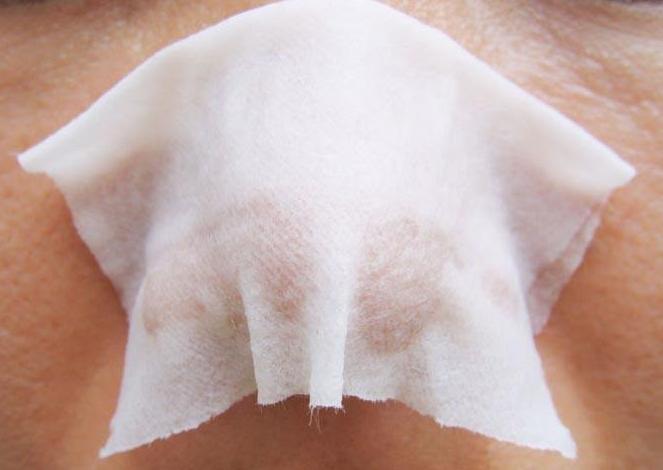 小苏打去黑头刺痛怎么回事,小苏打去黑头简单便宜效果又好