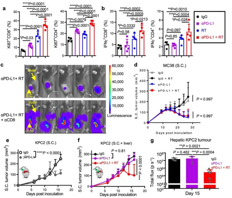 肝转移癌放疗效果好吗,转移肝肿瘤放疗有效吗