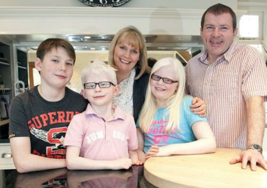 缺少黑色素但不是白化病,体内黑色素过少会引起白化病吗