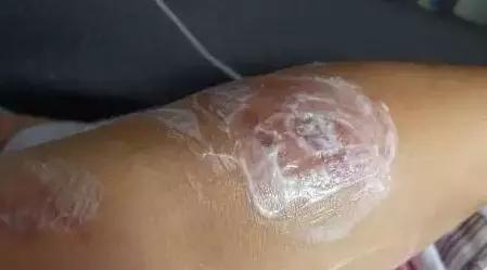 隐形虫出没地方,虫出没名场面