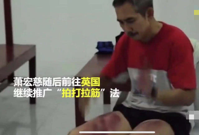 拍打拉筋治强直性脊柱炎成功案例,拍打拉筋治病视频