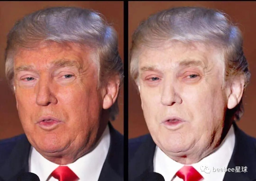 为什么老特的眼袋是白色的？