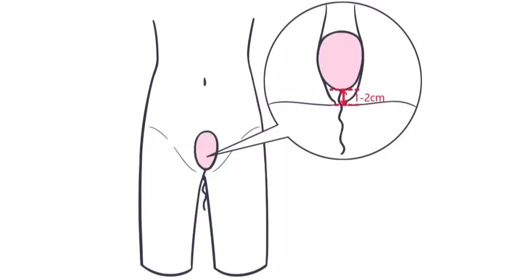 郭碧婷年轻的时候的颜值,郭碧婷生完小孩老了许多吗