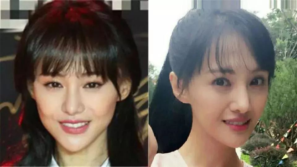 法令纹显老10岁三种方法帮助改善,最显老的法令纹怎么改善