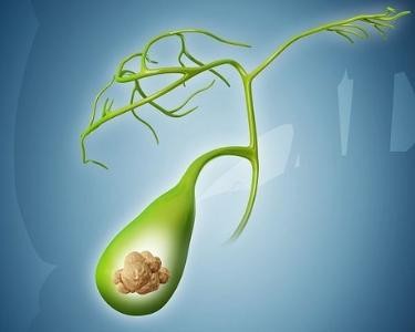 有些“肚子疼”延误不得，你需要了解这些知识