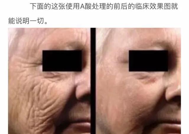 美国fda认可的top10保健品,去皱产品成分