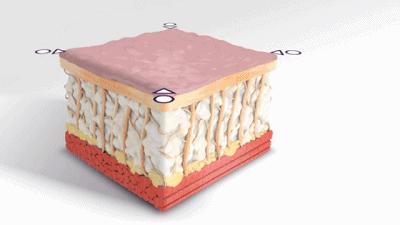 法令纹很严重显老怎么办,法令纹这么显老得如何搞定