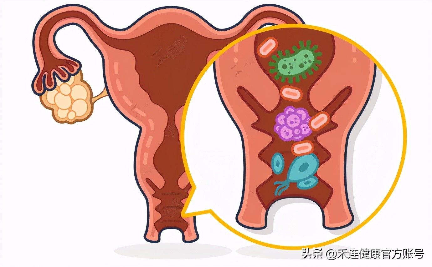 尴尬！同房时*处私**发出“噗噗”声，咋回事？
