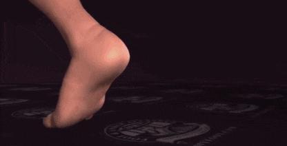 跟腱断裂原因分析,跟腱断裂发病机制