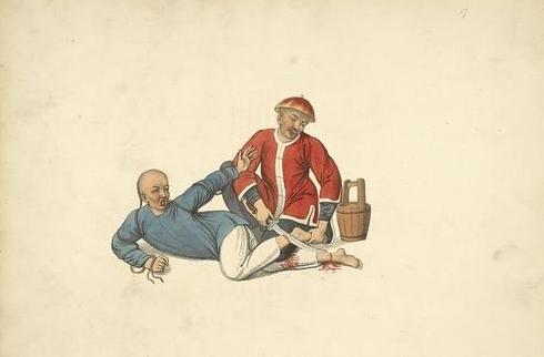 跟腱自发性断裂,跟腱断裂全负重行走