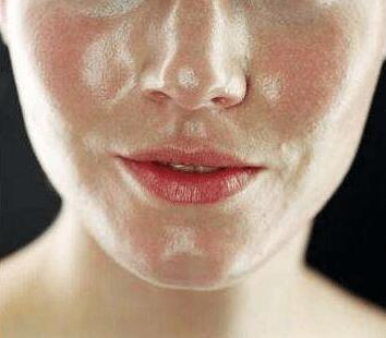 脸部螨虫多毛孔粗大,脸上螨虫毛孔粗大还能不能恢复