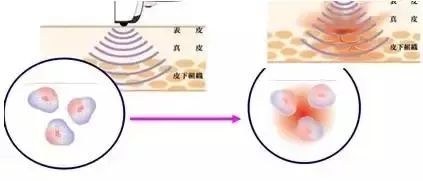 脸上不同部位长痘对应器官有问题,脸上长痘部位对应内脏