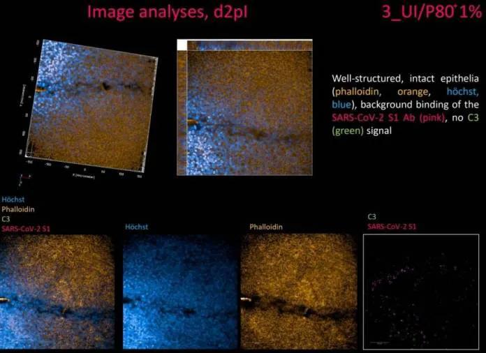 泰国朱拉大学药剂师团队成功研发预防新冠喷雾剂