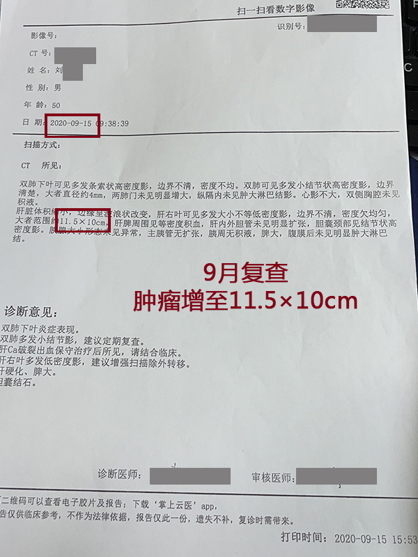 肝癌新发病例,肝癌肿瘤破裂出血会转移吗