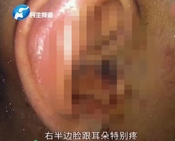 airpods爆炸耳出血,苹果耳机airpods爆炸事件