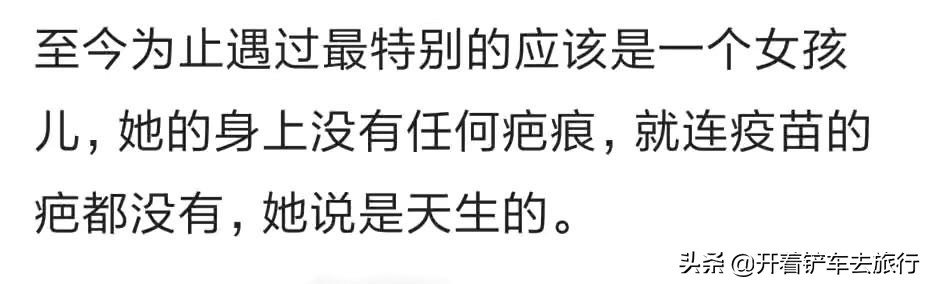 你见过最奇葩的过敏体质,你见过奇怪的过敏体质是什么