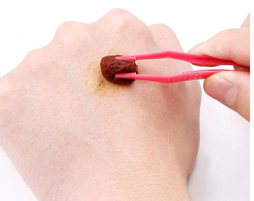 气管切口护理步骤,气管切口术后护理操作全过程视频