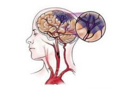 国际精神病日哪天,世界精神卫生日看法