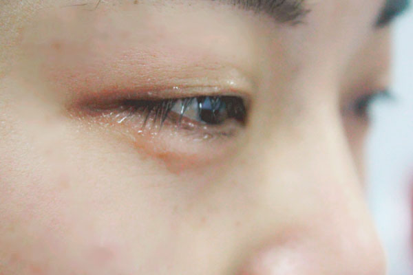 眼皮跳动是什么原因引起的,眼皮不定时跳是什么原因