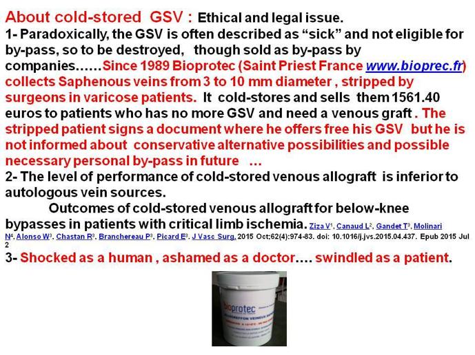 静脉曲张为什么要抽离大隐静脉,如何减轻和防止加重大隐静脉曲张