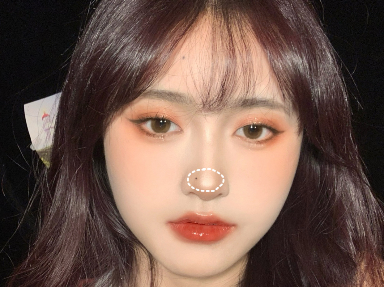 脸上哪个位置化妆化痣好看,脸上哪种点痣方法最好