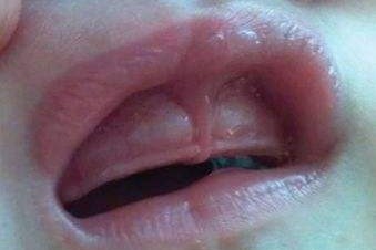 疫情防控期间突然牙痛,疫情之间牙疼我该怎么解决