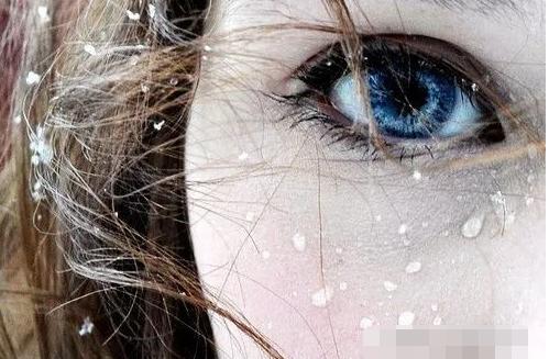 眼球震颤比较严重最好的解决方法,眼球震颤的症状是什么啊