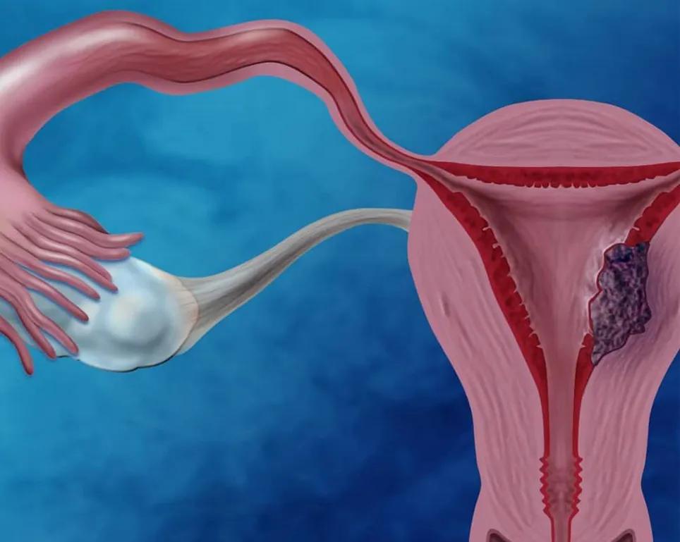 子宫壁薄医生不建议怀孕怎么办,子宫内膜薄可以怀疑吗