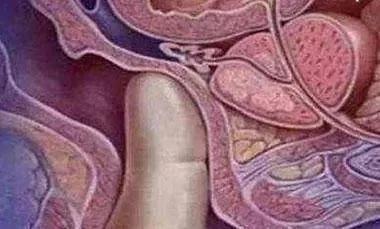 男医生的“一阳指”有多可怕?孕妈:尴尬到极点,能避开太幸运了