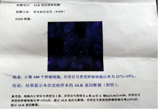 最新肺癌治疗指南,徐经世论治肺癌经验