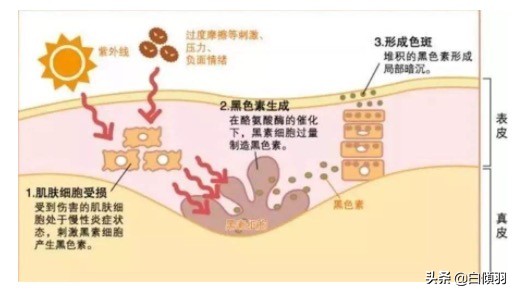 乱用护肤品怎么恢复,什么护肤品能让角质层变薄