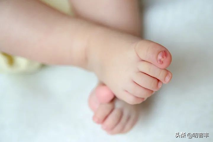 指甲嵌肉里了怎么办,婴儿嵌甲化脓擦什么