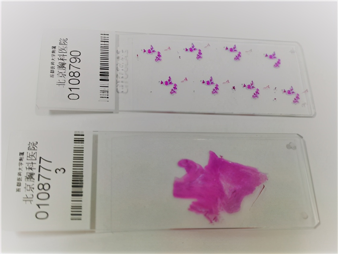 病理讲解视频全集,病理学讲解详细视频