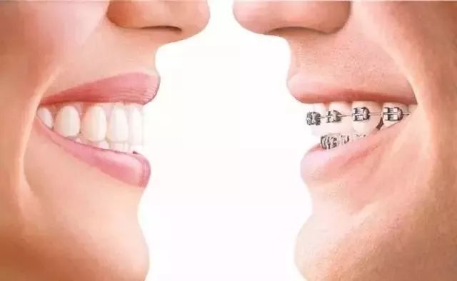 Helen齿科中心——牙齿不齐•影响健康