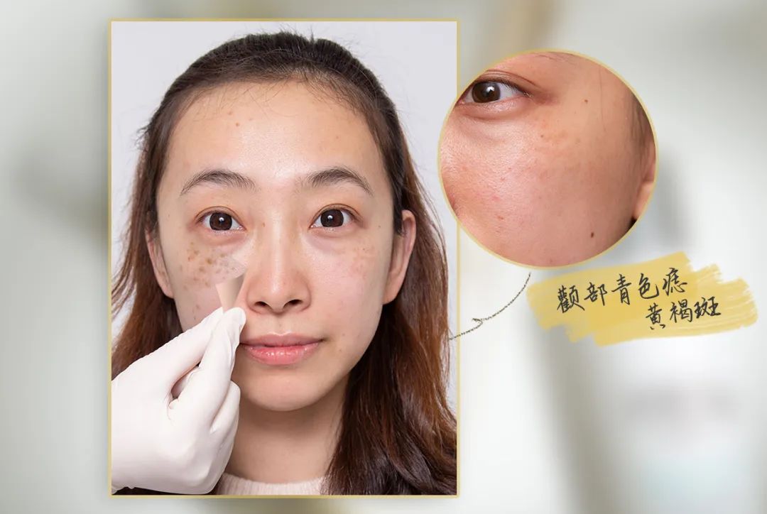 小茂医生美白护肤品,小茂教你如何护肤