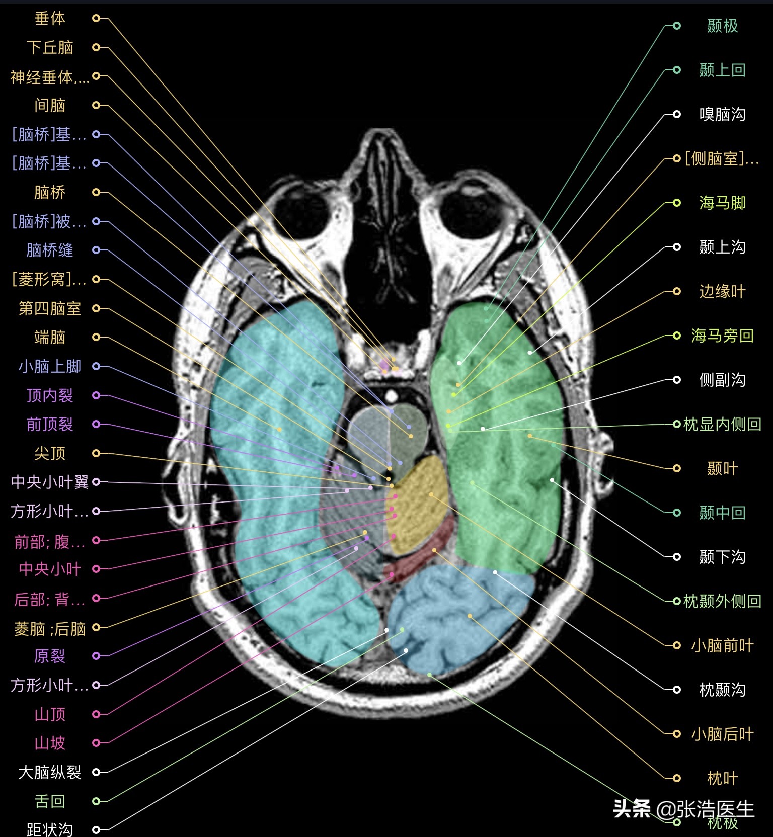 颅脑mri断层解剖视频课件,颅脑mri解剖手绘图