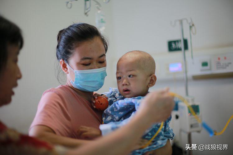 小孩摔一跤后引起眼袋淤青,2岁多男宝眼袋浮肿有点发紫